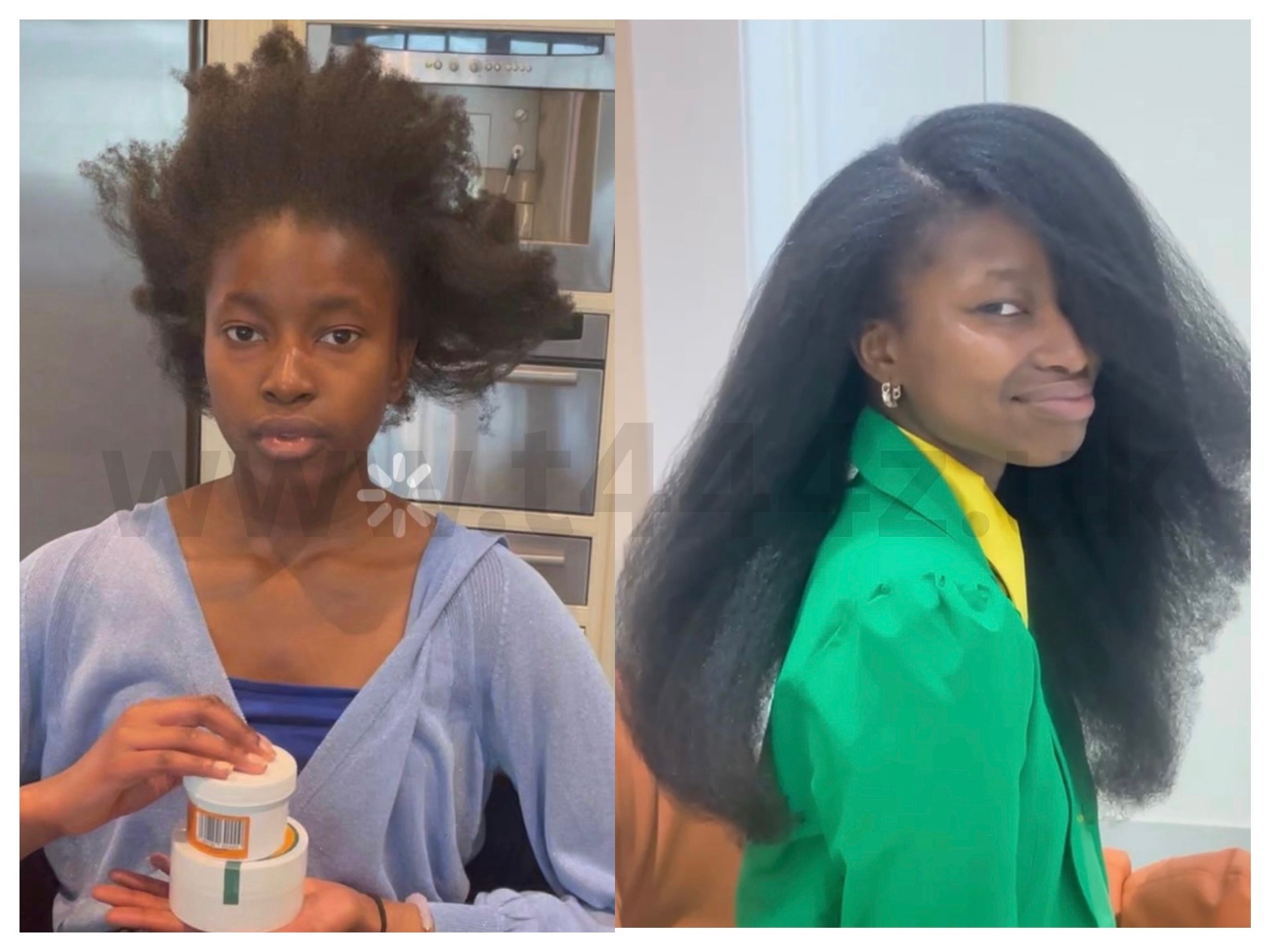 Before and after T444Z hair growth transformation